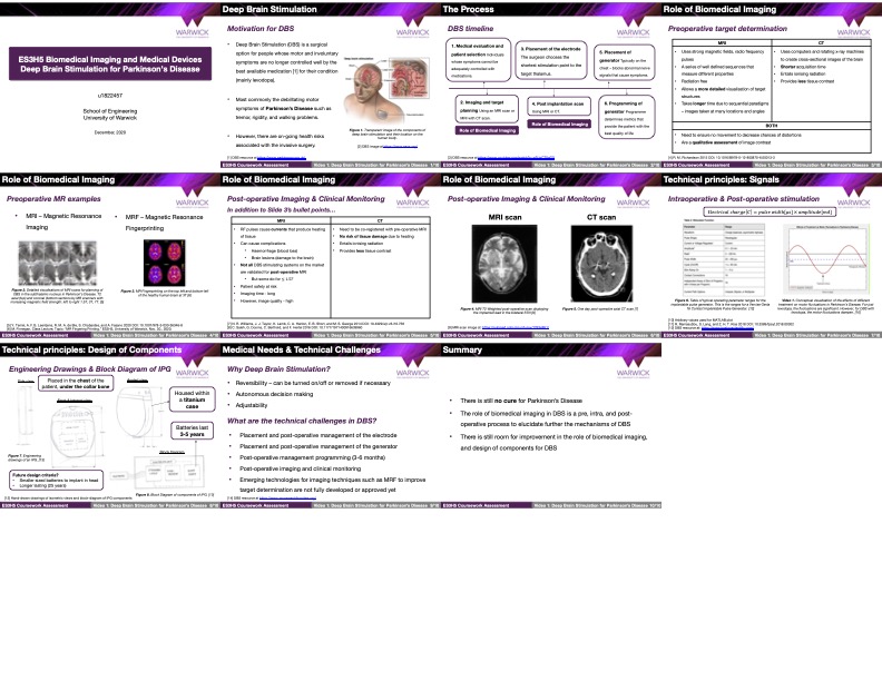 Third Year Biomedical DBS Presentation